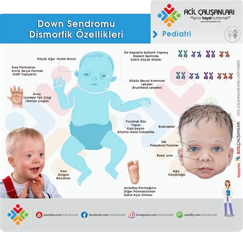 Meleklerin Dokunuşu: Down Sendromu ve Farklılıkların Gücü