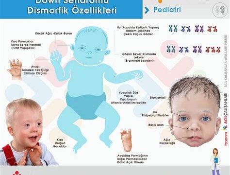 Meleklerin Dokunuşu: Down Sendromu ve Farklılıkların Gücü